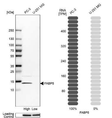 Western Blot: FABP5/E-FABP Antibody [NBP2-38659]