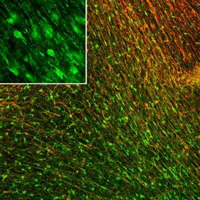 Immunocytochemistry/ Immunofluorescence: FABP7/B-FABP Antibody [NBP3-05531]
