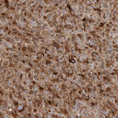 Immunohistochemistry-Paraffin: FABP7/B-FABP Antibody [NBP1-88648]