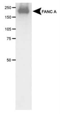 Western Blot: FACA/FANCA Antibody [NB100-2564]
