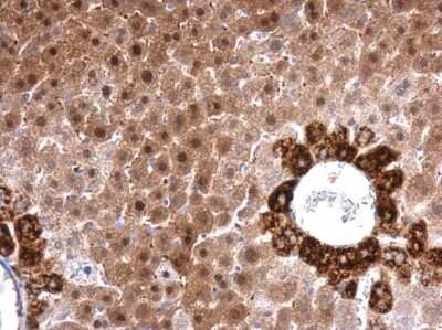 Immunohistochemistry-Paraffin: FACL4 Antibody (GT566) [NBP3-13526]