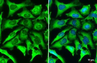 Immunocytochemistry/ Immunofluorescence: FACL4 Antibody (HL229) [NBP3-13666]
