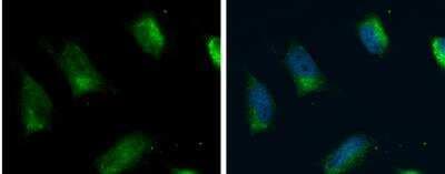 Immunocytochemistry/ Immunofluorescence: FACL4 Antibody [NBP2-16400]