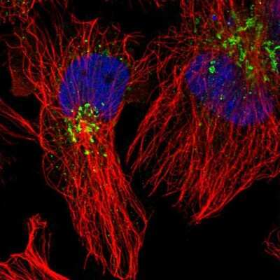 Immunocytochemistry/ Immunofluorescence: FACL4 Antibody [NBP2-55119]