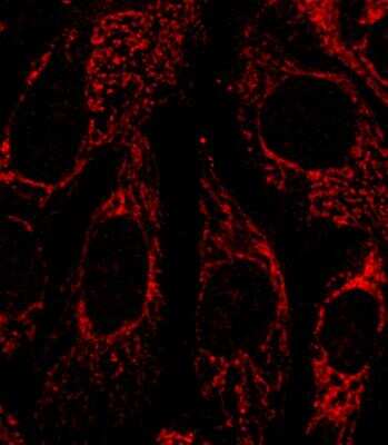 Immunocytochemistry/ Immunofluorescence: FACL4 Antibody [NBP2-16401]