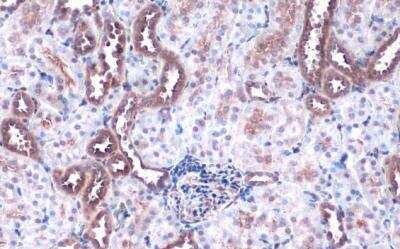 Immunohistochemistry-Paraffin: FACL4 Antibody [NBP2-16401]