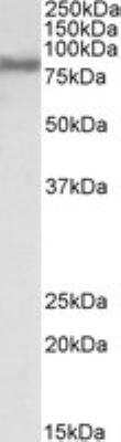 Western Blot: FACL4 Antibody [NB300-861]