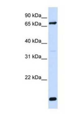 Western Blot: FACL4 Antibody [NBP1-69303]