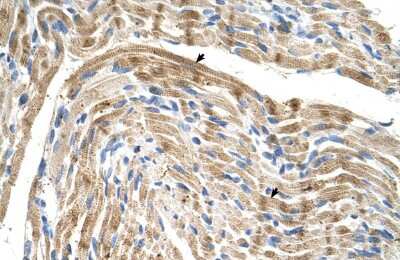 Immunohistochemistry-Paraffin: FADS1 Antibody [NBP1-60085]