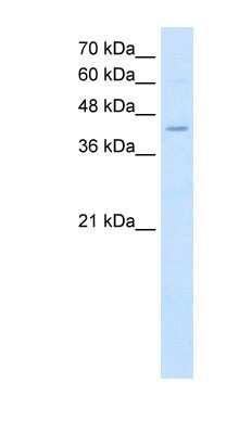 Western Blot: FADS1 Antibody [NBP1-60085]
