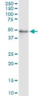 Western Blot: FADS3 Antibody (3D2) [H00003995-M07]