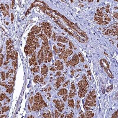 Immunohistochemistry-Paraffin: FADS3 Antibody [NBP1-91877]