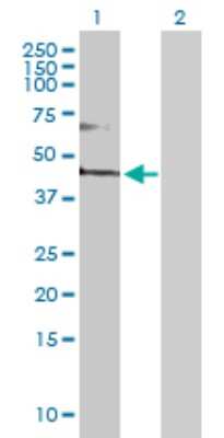 Western Blot: FADS3 Antibody [H00003995-D01P]
