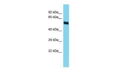 Western Blot: FADS3 Antibody [NBP2-87389]