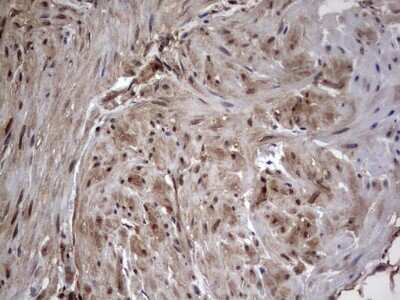 Immunohistochemistry: FAF1 Antibody (OTI10D1) [NBP2-45565]