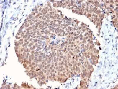 Immunohistochemistry-Paraffin: FAF1 Antibody (CPTC-FAF1-2) [NBP3-07506]
