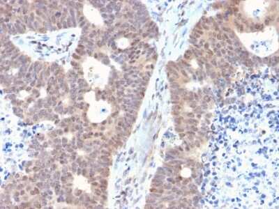 Immunohistochemistry-Paraffin: FAF1 Antibody (CPTC-FAF1-2) [NBP3-07506]