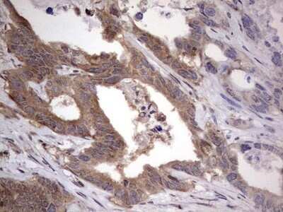 Immunohistochemistry: FAF1 Antibody (OTI10D1) - Azide and BSA Free [NBP2-71679]