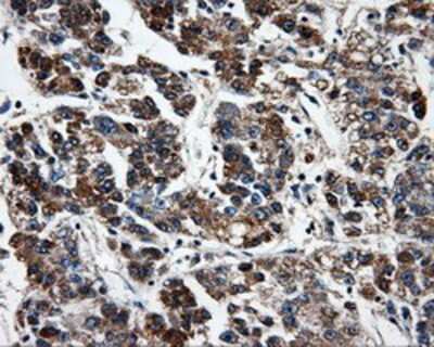 Immunohistochemistry-Paraffin: FAHD2A Antibody (OTI6D9) [NBP2-02331]