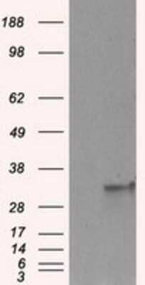 Western Blot: FAHD2A Antibody (OTI6D9) [NBP2-02331]