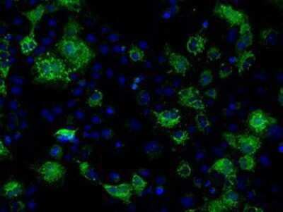 Immunocytochemistry/ Immunofluorescence: FAHD2A Antibody (OTI6D9) - Azide and BSA Free [NBP2-71886]
