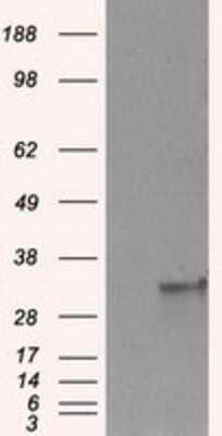 Western Blot: FAHD2A Antibody (OTI6D9)Azide and BSA Free [NBP2-71886]