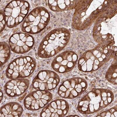 Immunohistochemistry: FAIM1 Antibody [NBP2-47463]