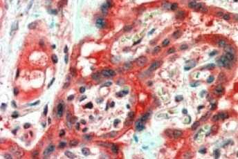 Immunohistochemistry-Paraffin: FAIM1 Antibody [NB100-77331]