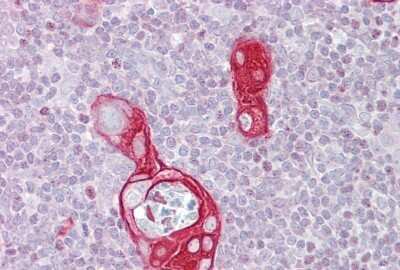Immunohistochemistry-Paraffin: FAIM1 Antibody [NBP1-55209]