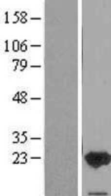 Western Blot: FAIM1 Overexpression Lysate [NBL1-10431]