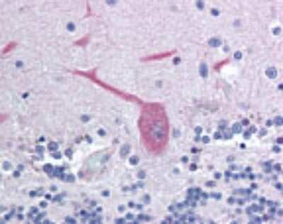 Immunohistochemistry: FAIM2 Antibody - Azide Free [NBP2-33257]