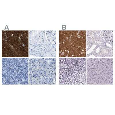 Immunohistochemistry-Paraffin: FAIM2 Antibody [NBP1-81456]