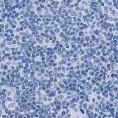 Immunohistochemistry-Paraffin: FAIM2 Antibody [NBP1-81456]