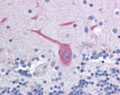 Immunohistochemistry-Paraffin: FAIM2 Antibody [NBP2-24713]