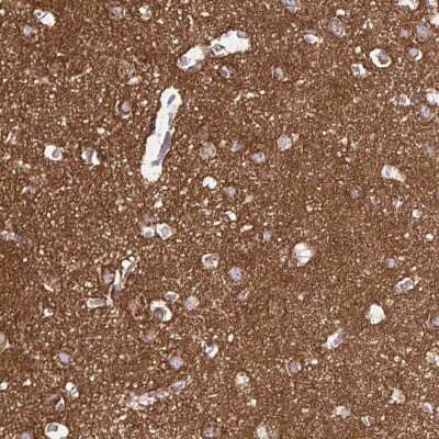Immunohistochemistry-Paraffin: FAIM2 Antibody [NBP2-33537]