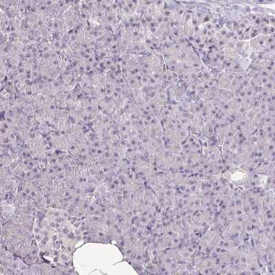 Immunohistochemistry-Paraffin: FAIM2 Antibody [NBP2-33537]