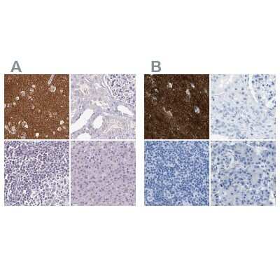 Immunohistochemistry-Paraffin: FAIM2 Antibody [NBP2-33537]