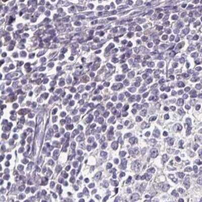 Immunohistochemistry-Paraffin: FAIM2 Antibody [NBP2-33537]