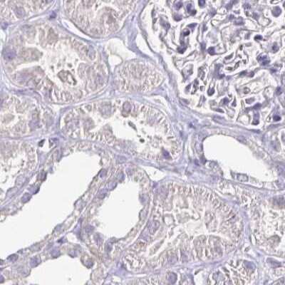 Immunohistochemistry-Paraffin: FAIM2 Antibody [NBP2-33537]