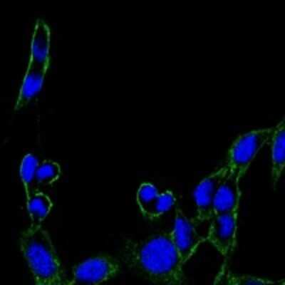 Immunocytochemistry/ Immunofluorescence: FAK Antibody (10H7) - BSA Free [NBP2-22168]