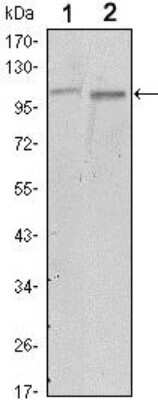 Western Blot: FAK Antibody (10H7)BSA Free [NBP2-22168]