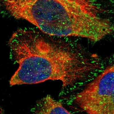 Immunocytochemistry/ Immunofluorescence: FAK Antibody [NBP1-84750]
