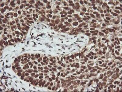 Immunohistochemistry: FAK Antibody (OTI4D11) - Azide and BSA Free [NBP2-71268]