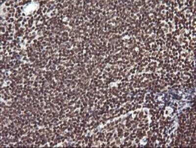 Immunohistochemistry: FAK Antibody (OTI4D11) - Azide and BSA Free [NBP2-71268]