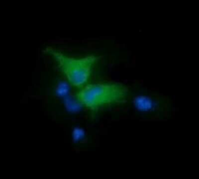Immunocytochemistry/ Immunofluorescence: FAK Antibody (OTI4D11) [NBP2-45923]