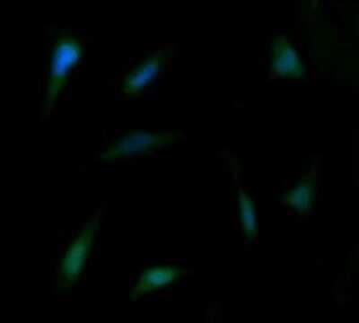 Immunocytochemistry/ Immunofluorescence: FAK Antibody (OTI4D11) [NBP2-45923]