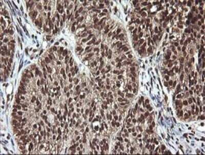 Immunohistochemistry: FAK Antibody (OTI4D11) [NBP2-45923]