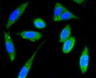 Immunocytochemistry/ Immunofluorescence: FAK Antibody (SR46-04) [NBP2-67327]