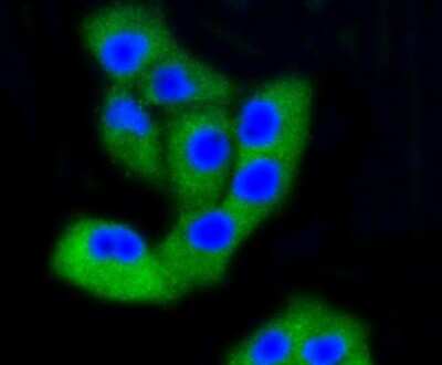 Immunocytochemistry/ Immunofluorescence: FAK Antibody (SR46-04) [NBP2-67327]