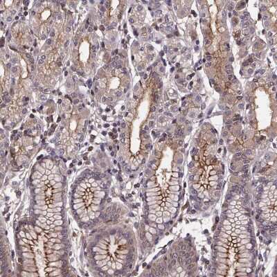 Immunohistochemistry: FAKD3 Antibody [NBP2-39095]